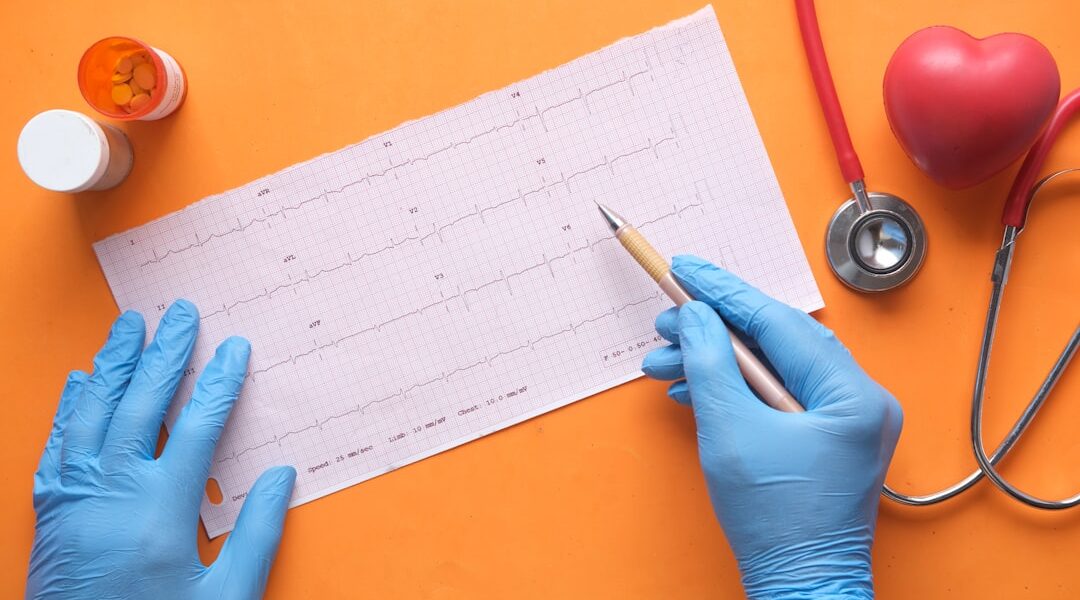 Hands wearing blue gloves holding a pen pointing at an ECG graph with medical equipment nearby.