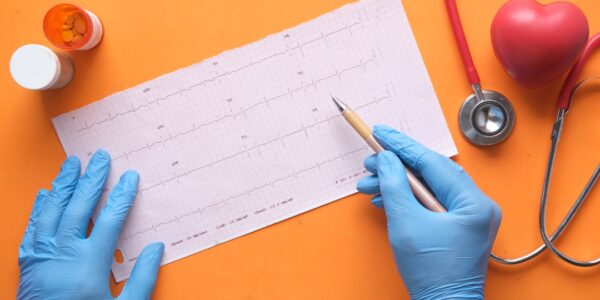 Hands wearing blue gloves holding a pen pointing at an ECG graph with medical equipment nearby.